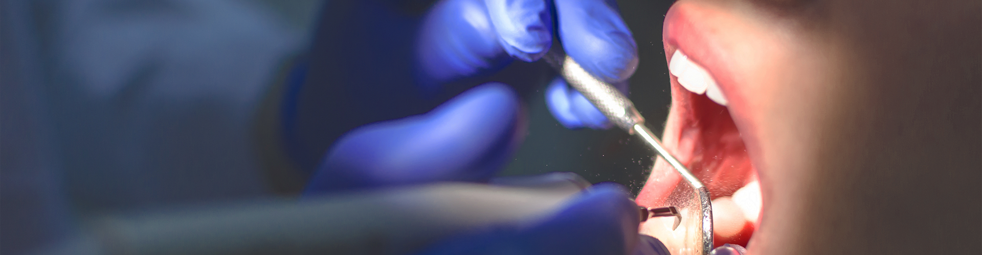 dentist using dental tools in woman's mouth